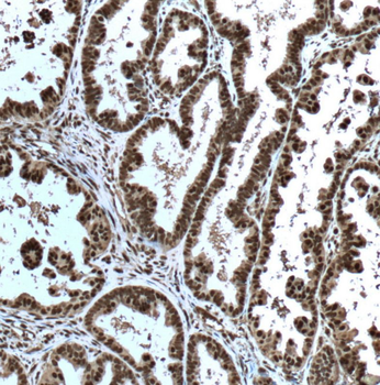 ERK1/2 Antibody