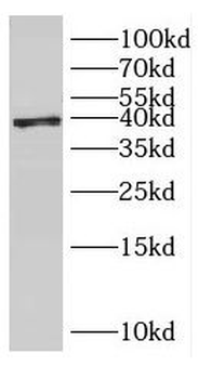 ERLIN2 Antibody