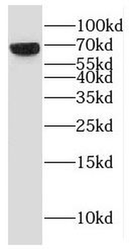 ESCO2 Rabbit Polyclonal Antibody