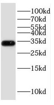 ESD Rabbit Polyclonal Antibody