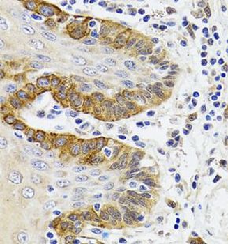 ESD Rabbit Polyclonal Antibody