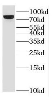 ESRP2 Rabbit Polyclonal Antibody