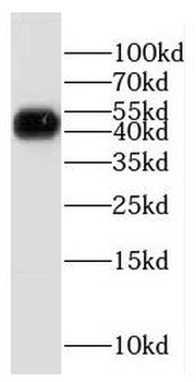 ETF1 Rabbit Polyclonal Antibody