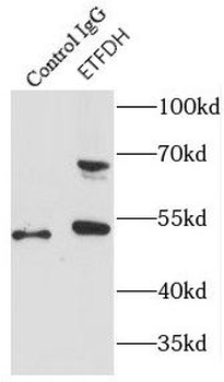 ETFDH Rabbit Polyclonal Antibody