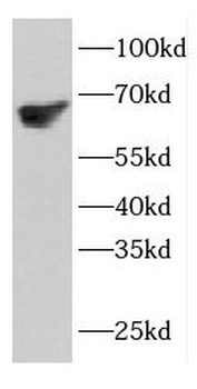 ETFDH Rabbit Polyclonal Antibody