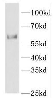 ETV4 Rabbit Polyclonal Antibody
