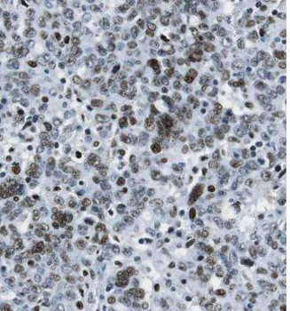ETV4 Rabbit Polyclonal Antibody