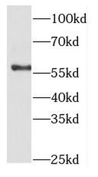 ETV5 Rabbit Polyclonal Antibody