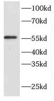 EXD2 Rabbit Polyclonal Antibody