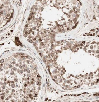 EXD2 Rabbit Polyclonal Antibody