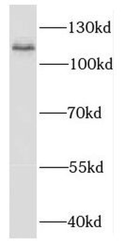 EXOC6 Rabbit Polyclonal Antibody