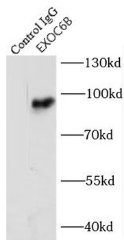EXOC6B Rabbit Polyclonal Antibody