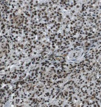 EXOSC10 Rabbit Polyclonal Antibody