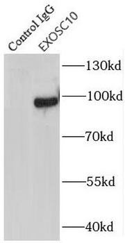 EXOSC10 Rabbit Polyclonal Antibody