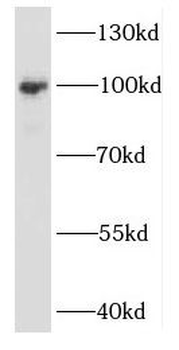EXOSC10 Rabbit Polyclonal Antibody