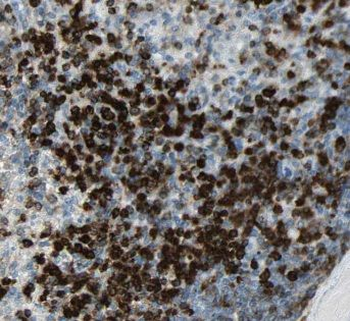 EXOSC10 Rabbit Polyclonal Antibody