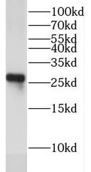 EXOSC4 Rabbit Polyclonal Antibody