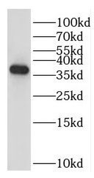 EXOSC7 Rabbit Polyclonal Antibody