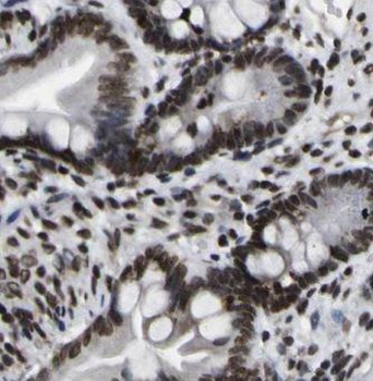 EXOSC7 Rabbit Polyclonal Antibody