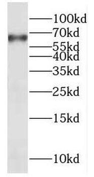 EXOSC9 Rabbit Polyclonal Antibody