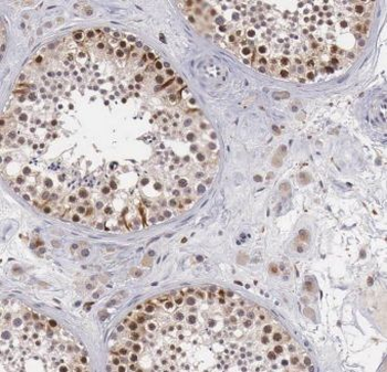 EXOSC9 Rabbit Polyclonal Antibody