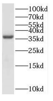 EXTL2 Rabbit Polyclonal Antibody