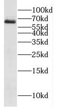 EXTL3 Rabbit Polyclonal Antibody
