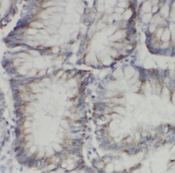 EXTL3 Rabbit Polyclonal Antibody