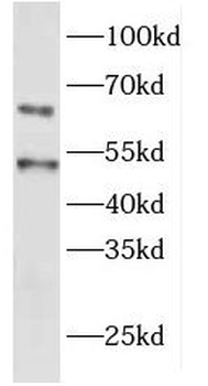 EYA1 Rabbit Polyclonal Antibody