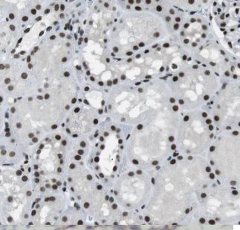 EYA1 Rabbit Polyclonal Antibody