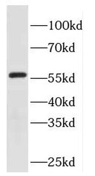 EYA2 Rabbit Polyclonal Antibody