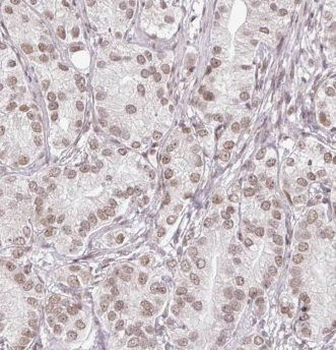 EYA2 Rabbit Polyclonal Antibody
