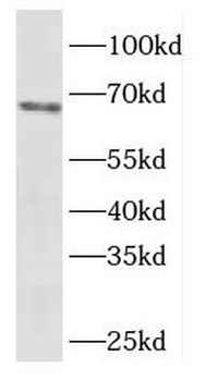 EYA4 Rabbit Polyclonal Antibody