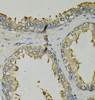 FABP1 Rabbit Polyclonal Antibody