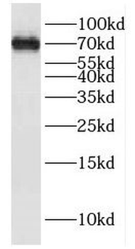 FAF1 Rabbit Polyclonal Antibody