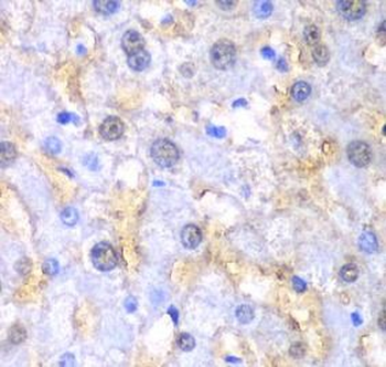 FAH Rabbit Polyclonal Antibody