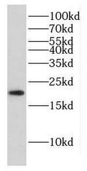 FAIM Rabbit Polyclonal Antibody