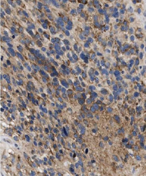 FAIM Rabbit Polyclonal Antibody