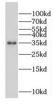OTULINL Rabbit Polyclonal Antibody