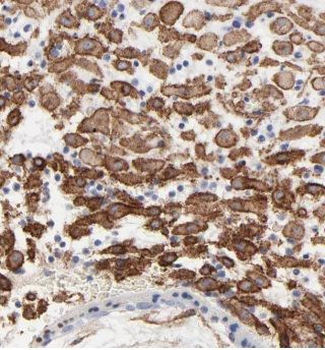 OTULINL Rabbit Polyclonal Antibody