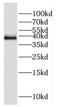 FAM118B Rabbit Polyclonal Antibody