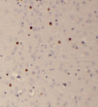 FAM118B Rabbit Polyclonal Antibody