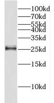 METTL21A Rabbit Polyclonal Antibody
