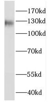 FAM120A Rabbit Polyclonal Antibody