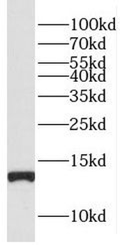 RTL8A Rabbit Polyclonal Antibody