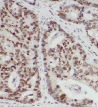 RTL8A Rabbit Polyclonal Antibody