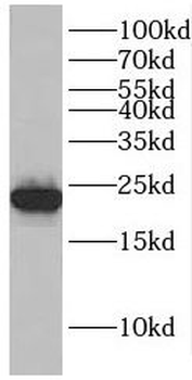 EMC9 Rabbit Polyclonal Antibody