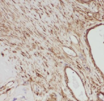 EMC9 Rabbit Polyclonal Antibody