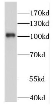 FHIP2A Rabbit Polyclonal Antibody