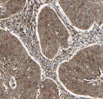 FAM168B Rabbit Polyclonal Antibody